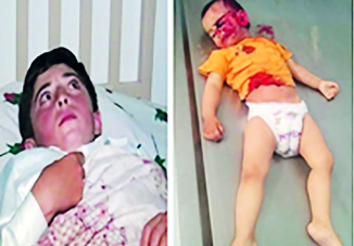 Война Саргсяна против азербайджанских детей: обреченная стратегия бесчестия