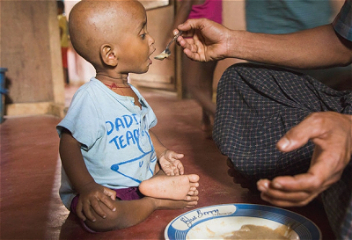 ООН выделила 100 миллионов долларовна предотвращение голода в семи странах