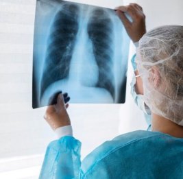 В Великобритании зафиксирован резкий рост заболеваемости туберкулезом