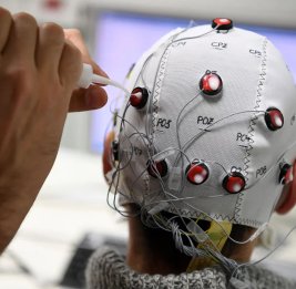 Китай впервые одобрил медицинское использование мозговых имплантов