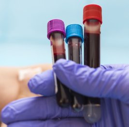 Японские медики открыли подтип рака крови, поражающий подростков