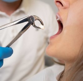 Туристка из России умерла после удаления зуба мудрости в Таиланде