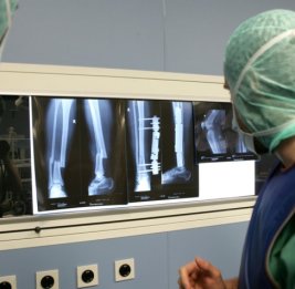 Врач назвал безопасную дозу радиации для человека