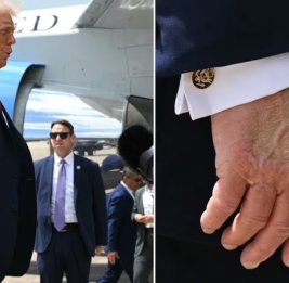 На руке Трампа снова заметили синяк