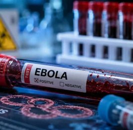 Число жертв вируса Эбола в ДР Конго превысило 860 человек