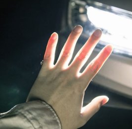 В Гяндже автомобиль насмерть сбил пешехода