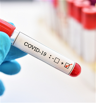 Чехия вышла на второе место в мире по уровню заболеваемости коронавирусом