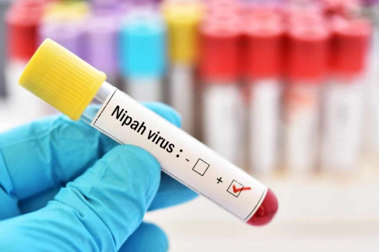 Планете угрожает смертельный вирус