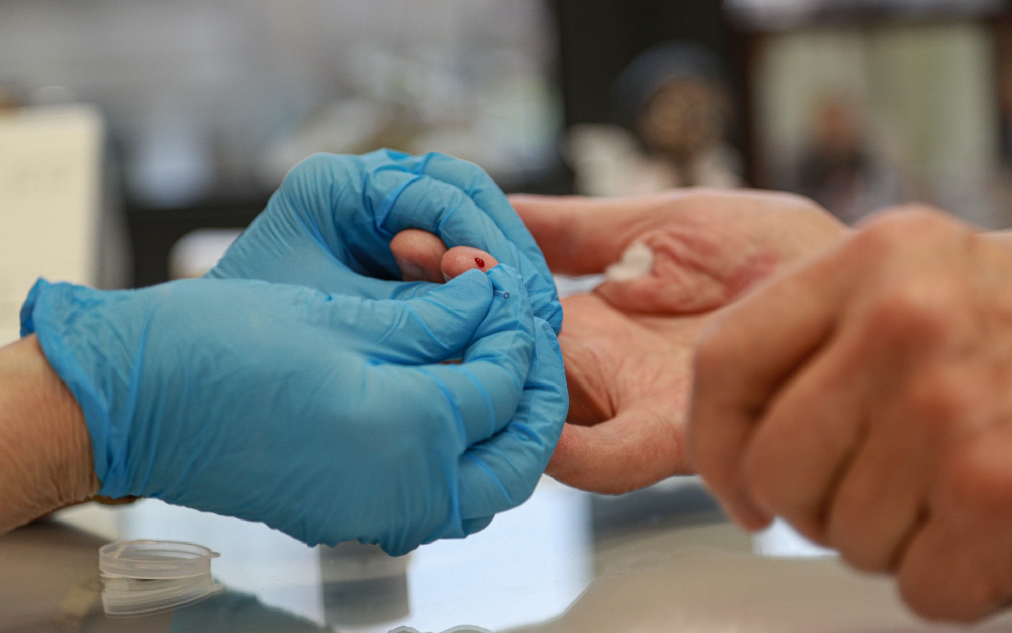 Врач рассказал, как часто нужно сдавать общий анализ крови