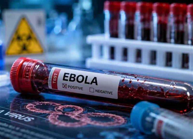 Число жертв вируса Эбола в ДР Конго превысило 860 человек