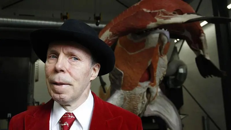Умер создатель выставки Body Worlds Гунтер фон Хагенс
